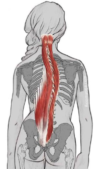 Mujer escoliosis